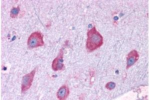 Anti-RPL22 antibody IHC staining of human brain, cortex. (RPL22 anticorps  (AA 106-119))