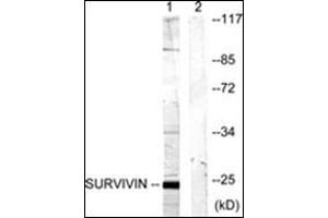 Western blot analysis of extracts from mouse lung cells, using Survivin Antibody . (Survivin anticorps)