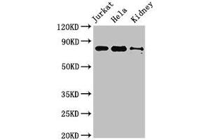 Western Blot Positive WB detected in: Jurkat whole cell lysate, Hela whole cell lysate, Mouse kidney tissue All lanes: NOA1 antibody at 3. (C4orf14 anticorps  (AA 42-174))
