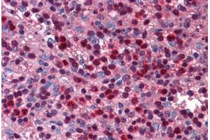 Human Spleen: Formalin-Fixed, Paraffin-Embedded (FFPE) (SIRT6 anticorps  (C-Term))