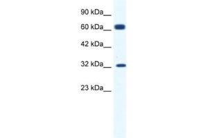 Western Blotting (WB) image for anti-Potassium Intermediate/small Conductance Calcium-Activated Channel, Subfamily N, Member 1 (KCNN1) antibody (ABIN2461099)
