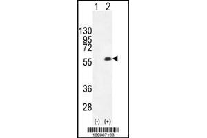Western blot analysis of PKMYT1 using rabbit polyclonal PKMYT1 C-term using 293 cell lysates (2 ug/lane) either nontransfected (Lane 1) or transiently transfected (Lane 2) with the PKMYT1 gene. (MYT1 anticorps  (C-Term))