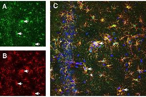 Multiplex staining of CD63 and GFAP in aged rat hippocampus.