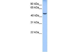 WB Suggested Anti-PHF17 Antibody Titration:  0. (PHF17 anticorps  (C-Term))