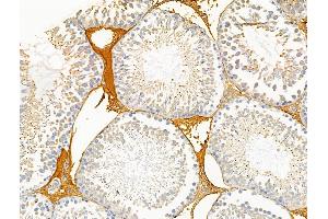ABIN6257536 and ABIN6274704 at 1/100 staining Rat testis tissue by IHC-P. (TRAF3IP3 anticorps  (Internal Region))
