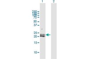 Western Blot analysis of PDGFA expression in transfected 293T cell line by PDGFA MaxPab polyclonal antibody. (PDGFA anticorps  (AA 1-211))