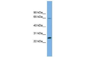 DHFRL1 antibody used at 1 ug/ml to detect target protein. (DHFRL1 anticorps  (Middle Region))