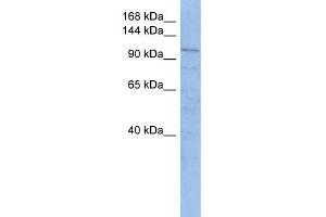 WB Suggested Anti-TRAK1 Antibody Titration: 0. (TRAK1 anticorps  (Middle Region))