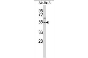 Western blot analysis in SK-BR-3 cell line lysates (35ug/lane). (PPM1A anticorps  (AA 355-382))