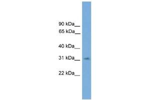 WB Suggested Anti-SPRY3 Antibody Titration:  0. (SPRY3 anticorps  (N-Term))