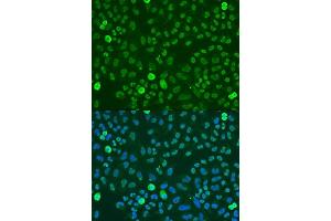 Immunofluorescence analysis of U2OS cells using SAFB antibody (ABIN7270155) at dilution of 1:100. (SAFB anticorps  (AA 300-400))