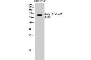 Western Blotting (WB) image for anti-Nuclear Factor-kB p65 (NFkBP65) (acLys122) antibody (ABIN3178882) (NF-kB p65 anticorps  (acLys122))