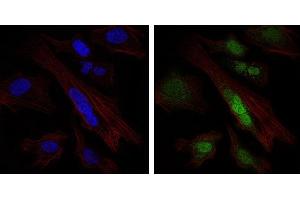 Immunofluorescence analysis of Hela cells using SOX9 mouse mAb (green). (SOX9 anticorps)