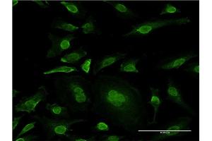 Immunofluorescence of monoclonal antibody to MAPK10 on HeLa cell.