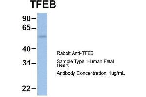 Host: Rabbit  Target Name: TFEB  Sample Tissue: Human Fetal Heart  Antibody Dilution: 1. (TFEB anticorps  (Middle Region))
