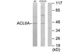 Western blot analysis of extracts from Jurkat/COLO205 cells, using ACTL6A Antibody. (BAF53A anticorps  (AA 201-250))