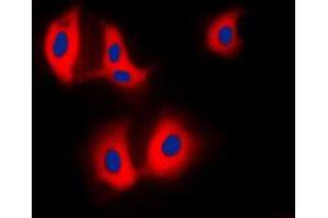 Immunofluorescent analysis of ALDOA staining in HepG2 cells. (ALDOA anticorps  (N-Term))