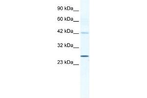 GJB4 antibody used at 1. (GJB4 anticorps  (Middle Region))