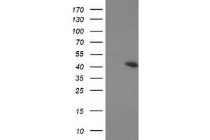 Western Blotting (WB) image for anti-Protein Kinase, CAMP-Dependent, Regulatory, Type I, beta (PRKAR1B) antibody (ABIN1500409) (PRKAR1B anticorps)