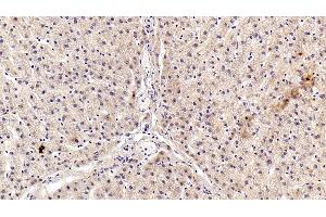 Detection of AngI in Porcine Liver Tissue using Polyclonal Antibody to Angiotensin I (AngI)