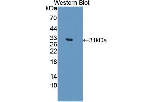 Detection of Recombinant CELSR3, Human using Polyclonal Antibody to Cadherin EGF LAG Seven Pass G-Type Receptor 3 (CELSR3)