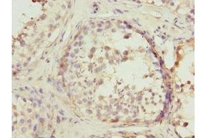 Immunohistochemistry of paraffin-embedded human testis tissue using ABIN7167503 at dilution of 1:100 (PTPRE anticorps)