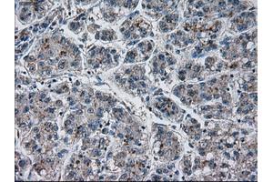 Immunohistochemical staining of paraffin-embedded Ovary tissue using anti-PRLmouse monoclonal antibody. (Prolactin anticorps)