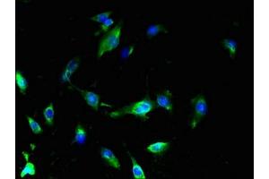 Immunofluorescent analysis of U251 cells using ABIN7159878 at dilution of 1:100 and Alexa Fluor 488-congugated AffiniPure Goat Anti-Rabbit IgG(H+L)