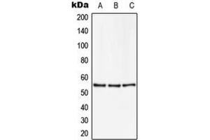 Western blot analysis of ZNF50 expression in U251MG (A), NIH3T3 (B), PC12 (C) whole cell lysates. (ZSCAN22 anticorps  (Center))