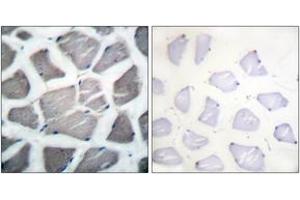 Immunohistochemistry analysis of paraffin-embedded human skeletal muscle tissue, using Bak Antibody.