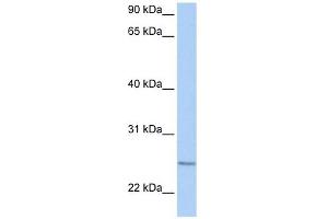RABL4 antibody used at 1 ug/ml to detect target protein. (RABL4 anticorps  (C-Term))