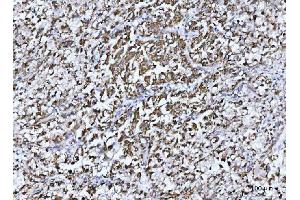 IHC analysis of GLUD1/2 using anti-GLUD1/2 antibody (ABIN7602000). (GLUD1 / GLUD2 (AA 54-553) anticorps)