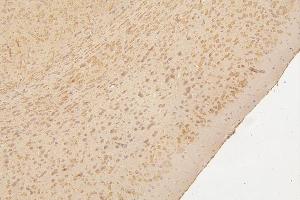 IHC analysis of SEMA3B using anti-SEMA3B antibody (ABIN6719617).