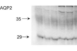 Western blot analysis of Rat kidney inner medullary homogenates showing detection of Aquaporin 2 protein using Rabbit Anti-Aquaporin 2 Polyclonal Antibody . (AQP2 anticorps  (C-Term) (FITC))