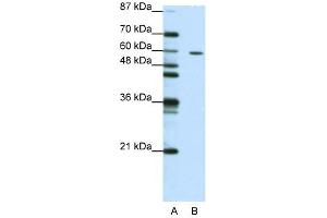 Western Blot showing ZNF382 antibody used at a concentration of 1-2 ug/ml to detect its target protein. (ZNF382 anticorps  (N-Term))
