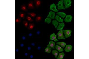 Phospho-YY1 (Ser365) Antibody staining Hela cells(heat shock treatment) by IF/ICC. (YY1 anticorps  (pSer365))