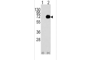 Western blot analysis of ACOX1 (arrow) using rabbit polyclonal ACOX1 Antibody (C-term) (R). (ACOX1 anticorps  (C-Term))