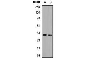 Western blot analysis of CD34 expression in HeLa (A), HepG2 (B) whole cell lysates. (CD34 anticorps  (Center))