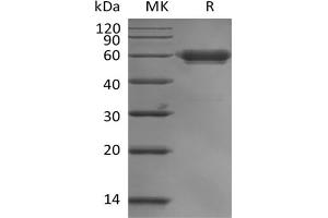 Western Blotting (WB) image for Leukocyte-Associated Immunoglobulin-Like Receptor 1 (LAIR1) protein (mFc Tag) (ABIN7319831)