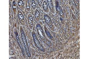 IHC analysis of PDIA6 using anti-PDIA6 antibody (ABIN7600553). (PDIA6 anticorps  (AA 20-440))