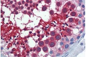 Human Testis: Formalin-Fixed, Paraffin-Embedded (FFPE)