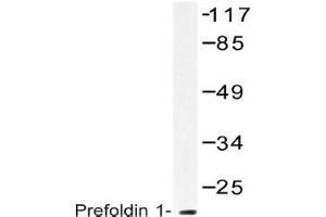 Western blot (WB) analysis of Prefoldin 1 antibody in extracts from RAW264. (PFDN1 anticorps)