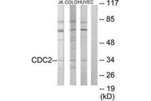 Western Blotting (WB) image for anti-Cyclin-Dependent Kinase 1 (CDK1) (AA 101-150) antibody (ABIN2889380) (CDK1 anticorps  (AA 101-150))