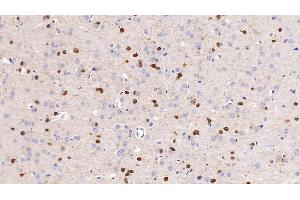 Detection of NGAL in Rat Cerebrum Tissue using Monoclonal Antibody to Neutrophil gelatinase-associated lipocalin (NGAL)