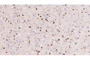 Detection of NGAL in Rat Cerebrum Tissue using Monoclonal Antibody to Neutrophil gelatinase-associated lipocalin (NGAL) (Lipocalin 2 anticorps  (AA 21-198))