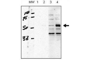 Western blot testing of human chondrocytes (C28/I2 cells), transfected with empty vector (lane 1, 3) or ALK1 (2, 4)