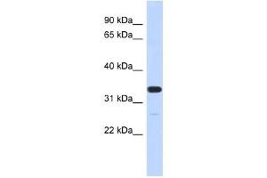 FAM76A antibody used at 1 ug/ml to detect target protein. (FAM76A anticorps  (N-Term))