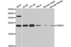 Western blot analysis of extracts of various cell lines, using CMPK1 antibody (ABIN5973940) at 1/1000 dilution. (Cytidine Monophosphate (UMP-CMP) Kinase 1, Cytosolic (CMPK1) anticorps)