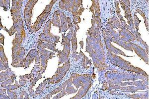 IHC analysis of RALBP1 using anti-RALBP1 antibody (ABIN7600800). (RALBP1 anticorps  (AA 239-506))