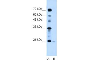 Western Blotting (WB) image for anti-Synovial Sarcoma, X Breakpoint 2 (SSX2) antibody (ABIN2461583) (SSX2 anticorps)